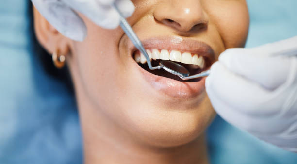 Best Urgent Care for Lost Fillings or Crowns in East Norwich, NY